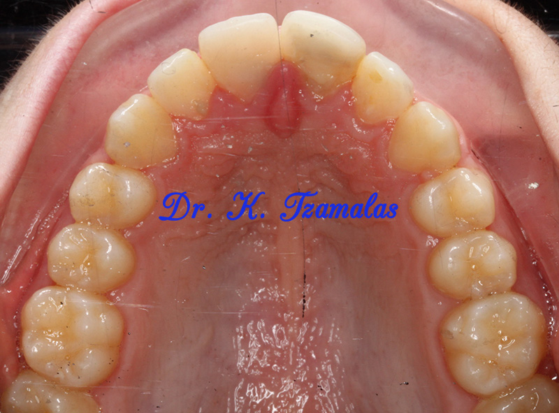 Athens Orthodontics | Dr. Κωνσταντίνος Τζαμάλας